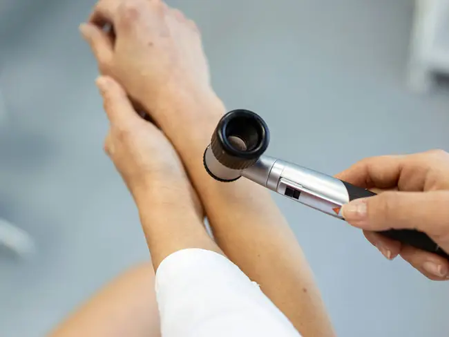 Hände eines Arztes untersuchen mit einem Dermatoskop die Haut am Unterarm einer Person in einer Hautarztpraxis.