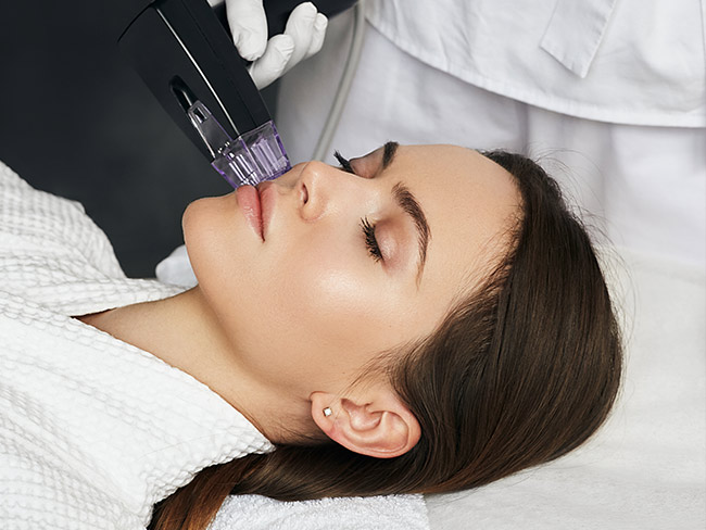 Eine Person liegt auf einer Behandlungsliege. Ein Hautarzt trägt weiße Handschuhe und hält ein medizinisches Gerät, das an der Wange der liegenden Person angesetzt wird. Das Gerät ist schwarz und hat eine längliche Form. Die Szene spielt in einer Hautarztpraxis und zeigt die Behandlung, Microneedling mit Morpheus 8